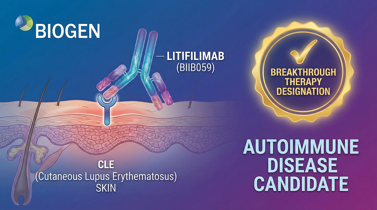 Biogen's Litifilimab Receives FDA Breakthrough Therapy Designation for Cutaneous Lupus Erythematosus